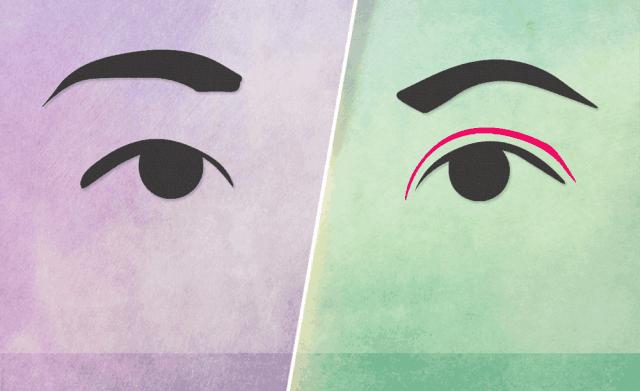 双眼皮真的有那么漂亮吗,自然双眼皮和割的双眼皮内在区别