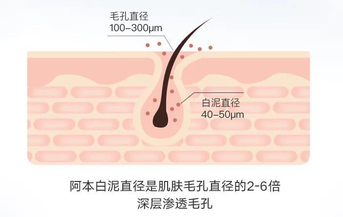 油性肌肤应该怎么样去除黑头,油腻皮肤毛孔粗大黑头多怎么清理