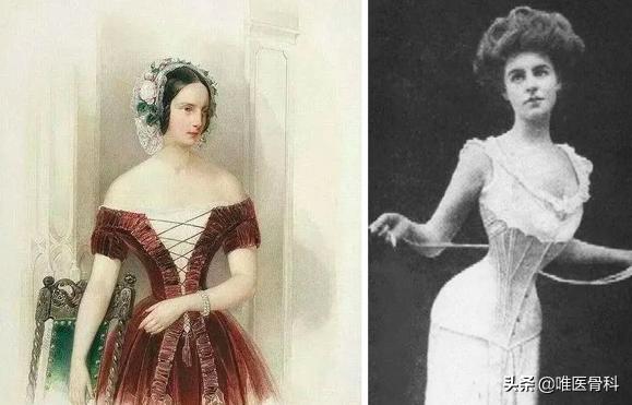 这要命的事千万别做！关于「束腰」你必须要知道的真相