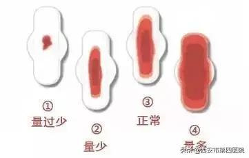 月经量突然少不正常原因,月经周期正常月经量少是什么原因