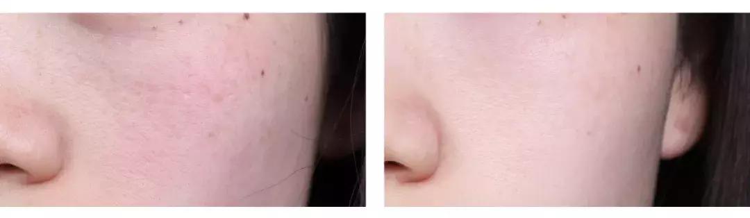 拿什么拯救你我的春日敏感肌,拿什么拯救你我的冬季敏感肌