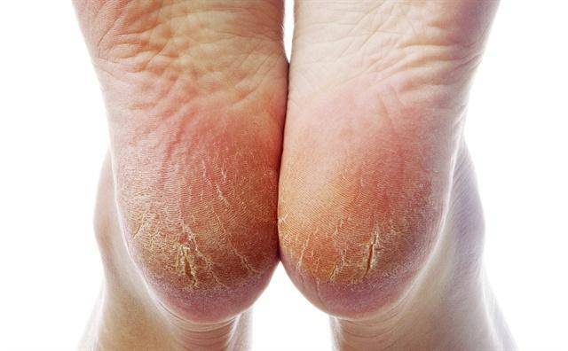 凡士林真好用吗,凡士林各种颜色的功效