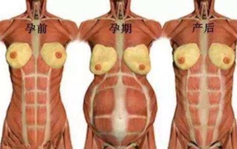 产后恢复的误区,产后恢复常见误区