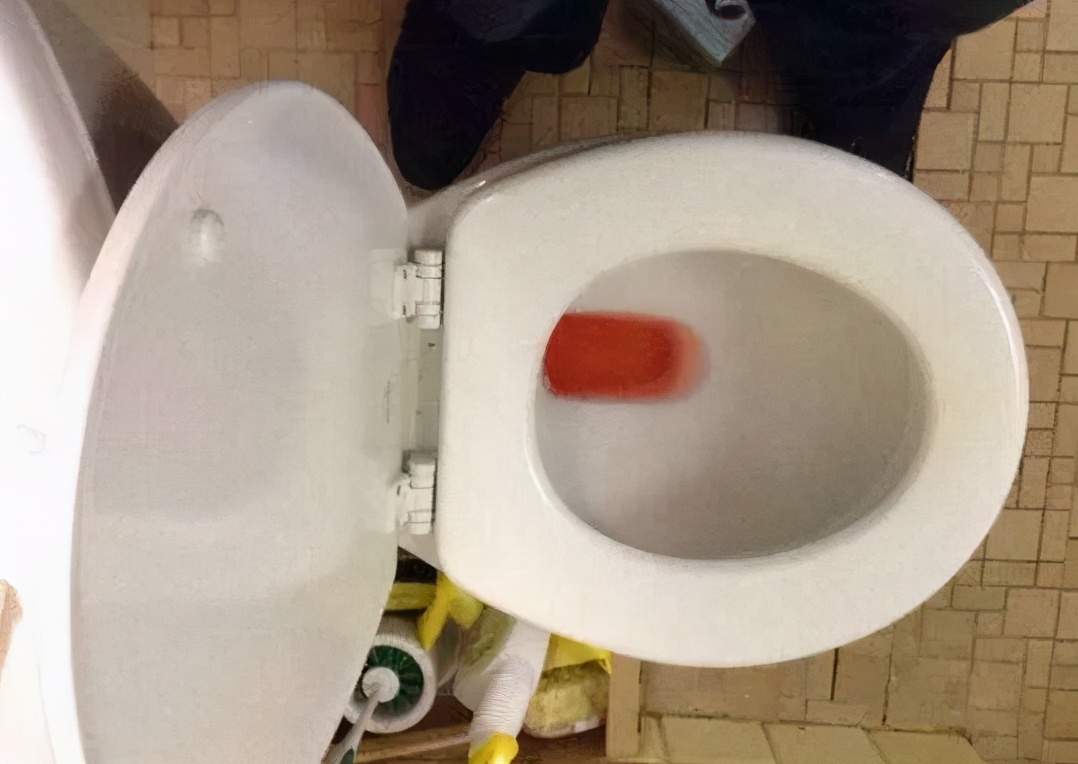 小便带血尿血是什么原因,小便带血是什么原因