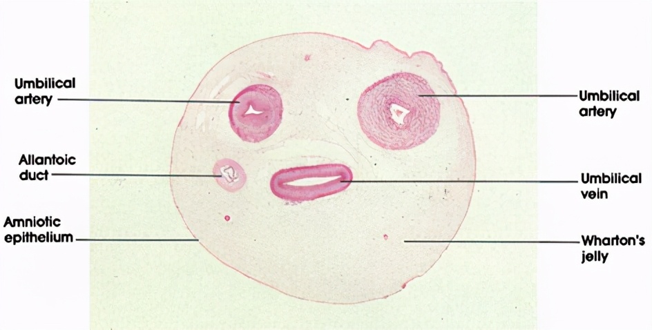 新生儿脐带容易被扯掉吗,新生儿脐带剪了是打结吗