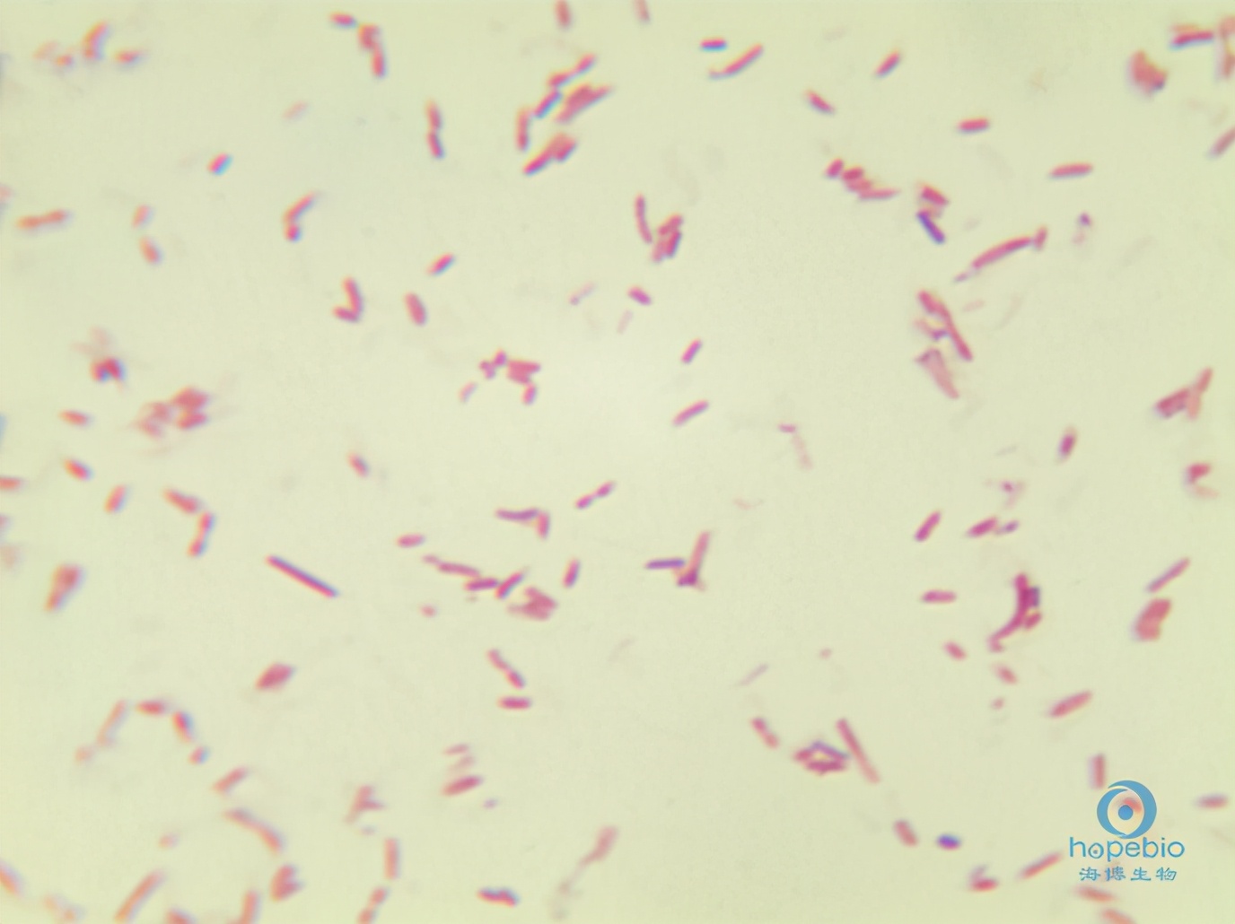 大肠埃希菌菌落计数10.5,大肠埃希氏菌计数3+严重吗