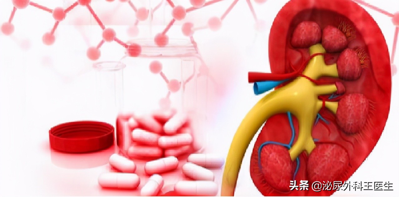 25岁小伙血肌酐1243住院治疗10天，肌酐下降到660，透析次数减少