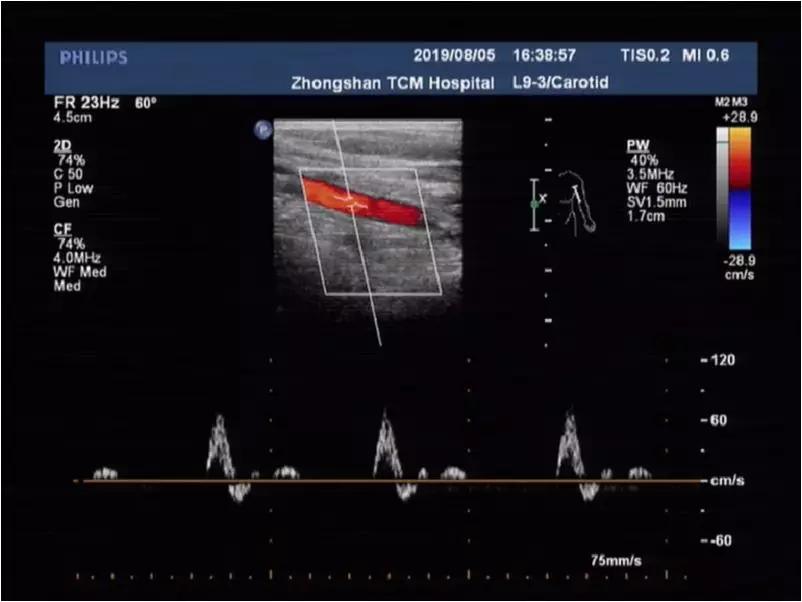 肩臂痛怎么治疗,肩臂痛什么原因