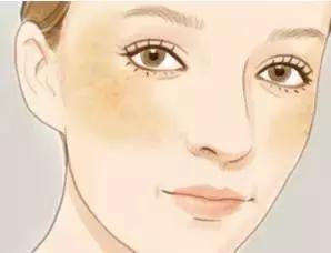 仙人掌有褐斑,仙人掌长褐斑