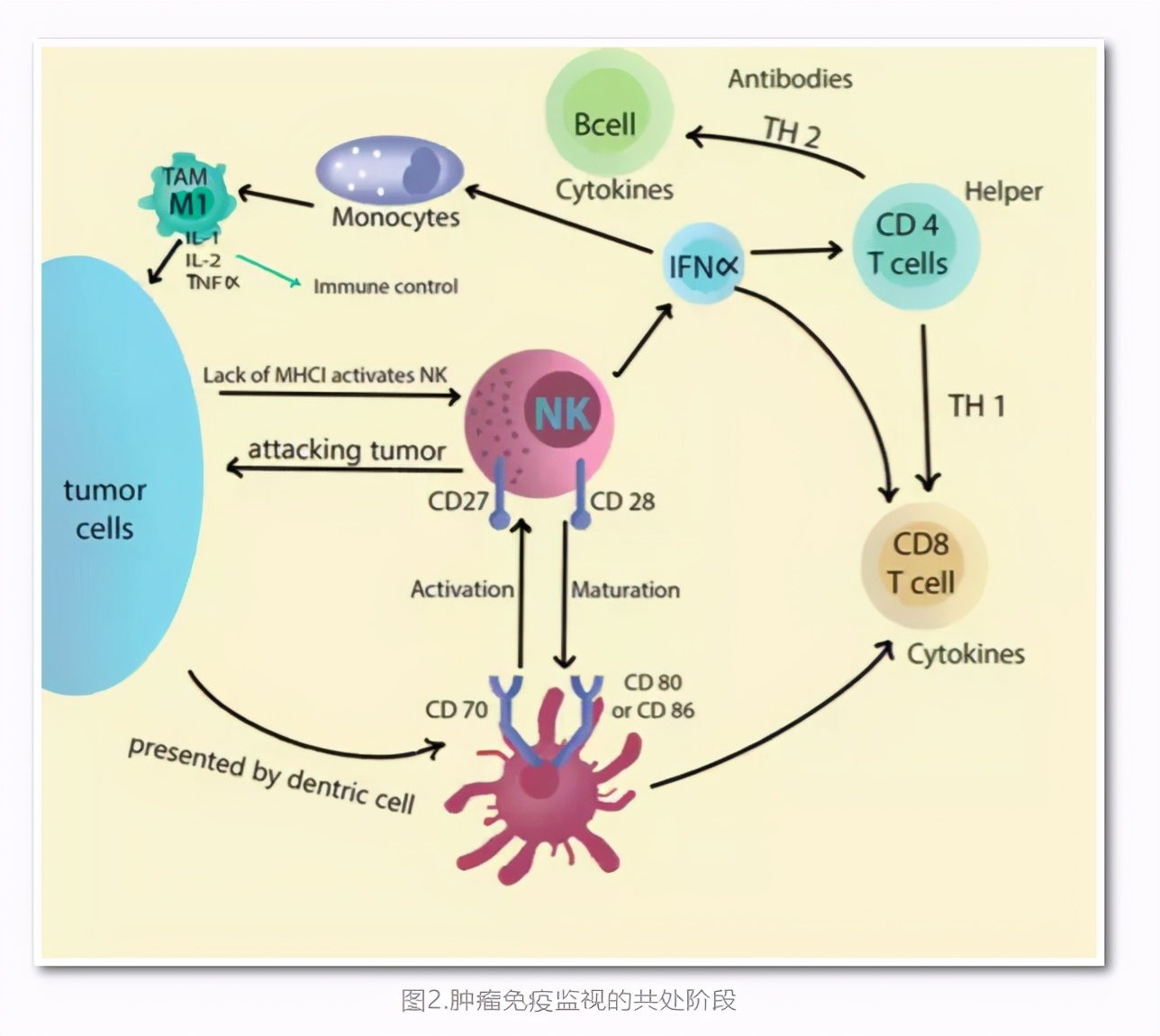 甲状腺癌晚期淋巴转移,甲状腺癌晚期全身酸痛