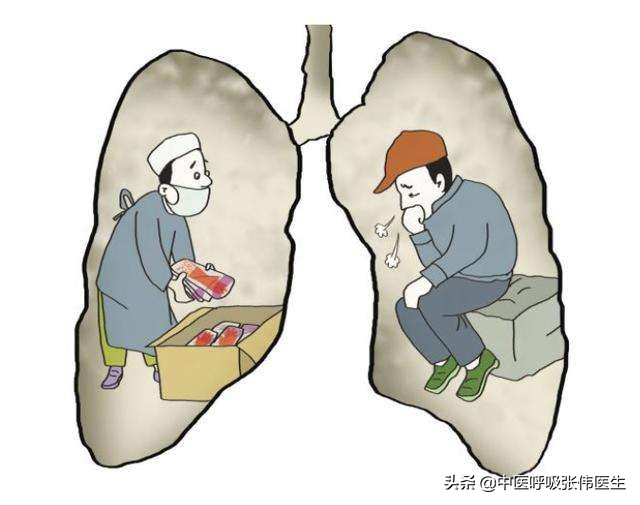 罕见肺结节,肺泡微石症