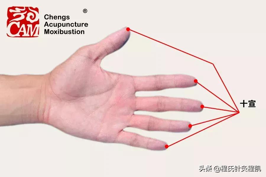 军训中暑的治疗方法,军训中暑怎么解决