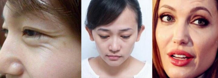 抗衰不再是简单的面部抗衰,风靡全球面部抗衰的最好方法