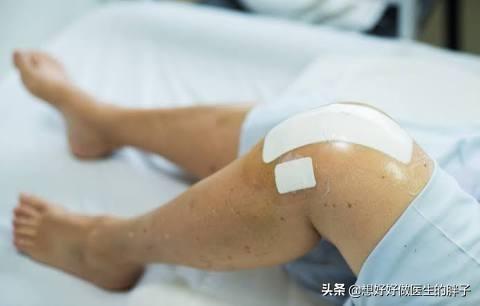 膝关节术后粘连药物治疗,膝关节手术后粘连最好的解决方法