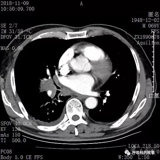 怎么应用统计学做调查,统计学方法可以解决的主要问题