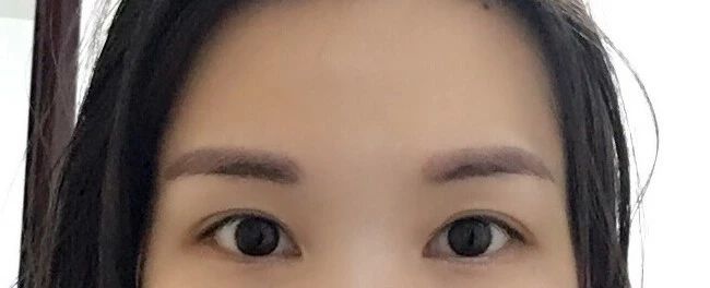 请别再怀疑潘贰做双眼皮手术切肌肉了，希望这是我最后一次澄清