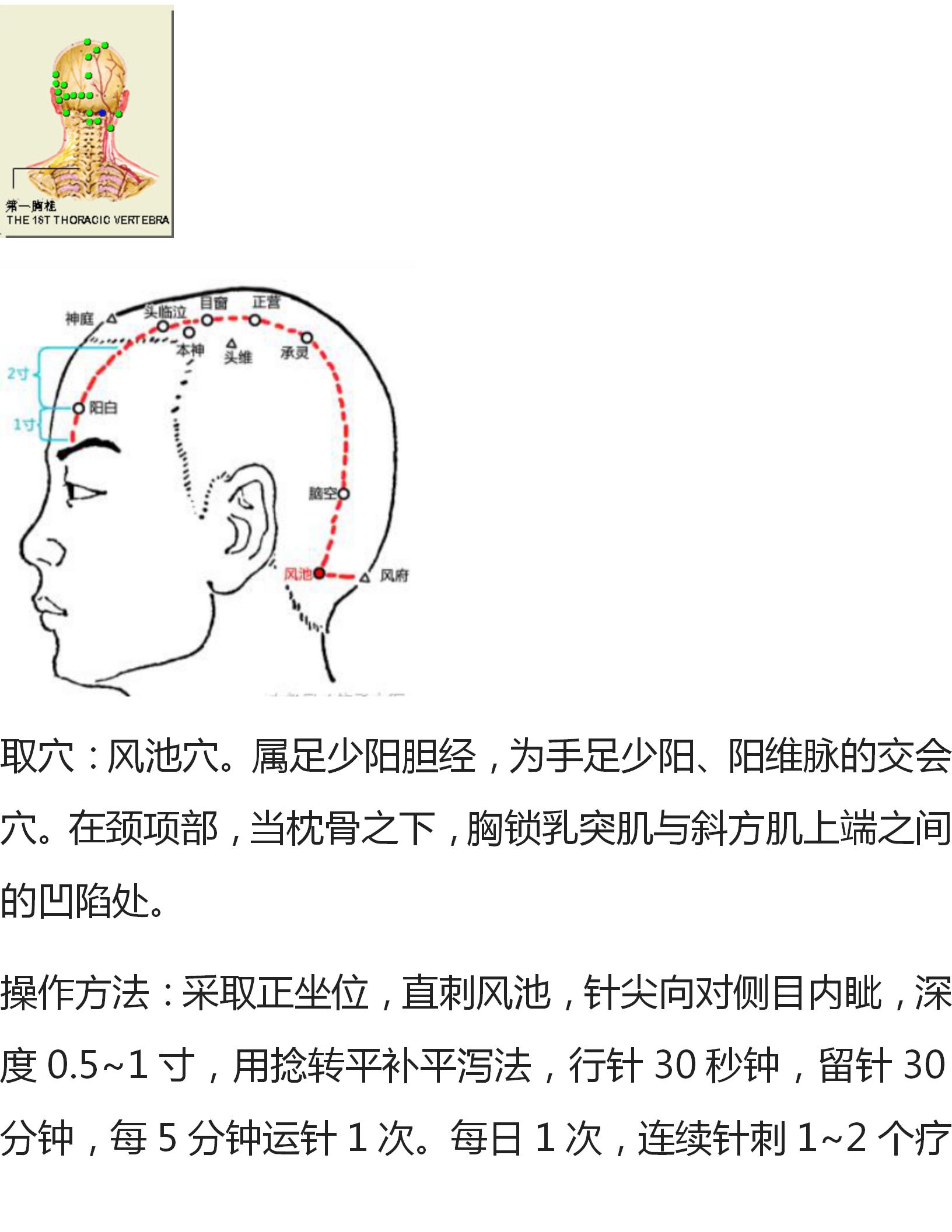 各种痛症的针灸方法,董氏奇穴大拇指腱鞘炎针灸取穴