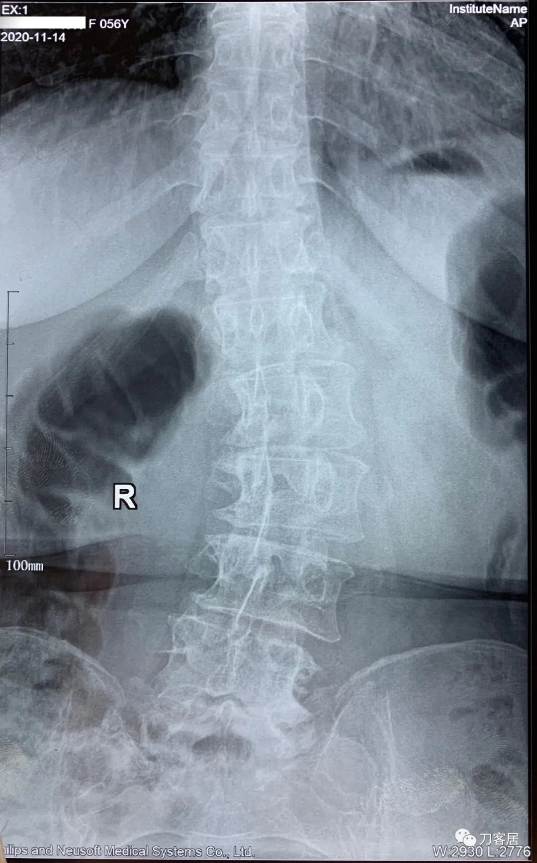 我的门诊病历,我的门诊