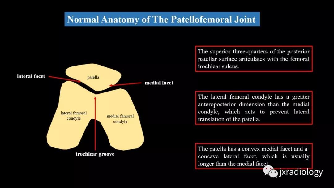 髌股关节失常磁共振看什么,髌股关节混乱的影像评估