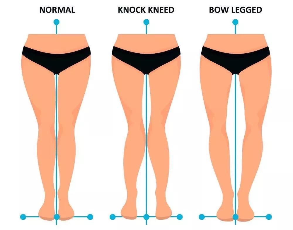 3个让人变丑的动作,容易变胖的姿势