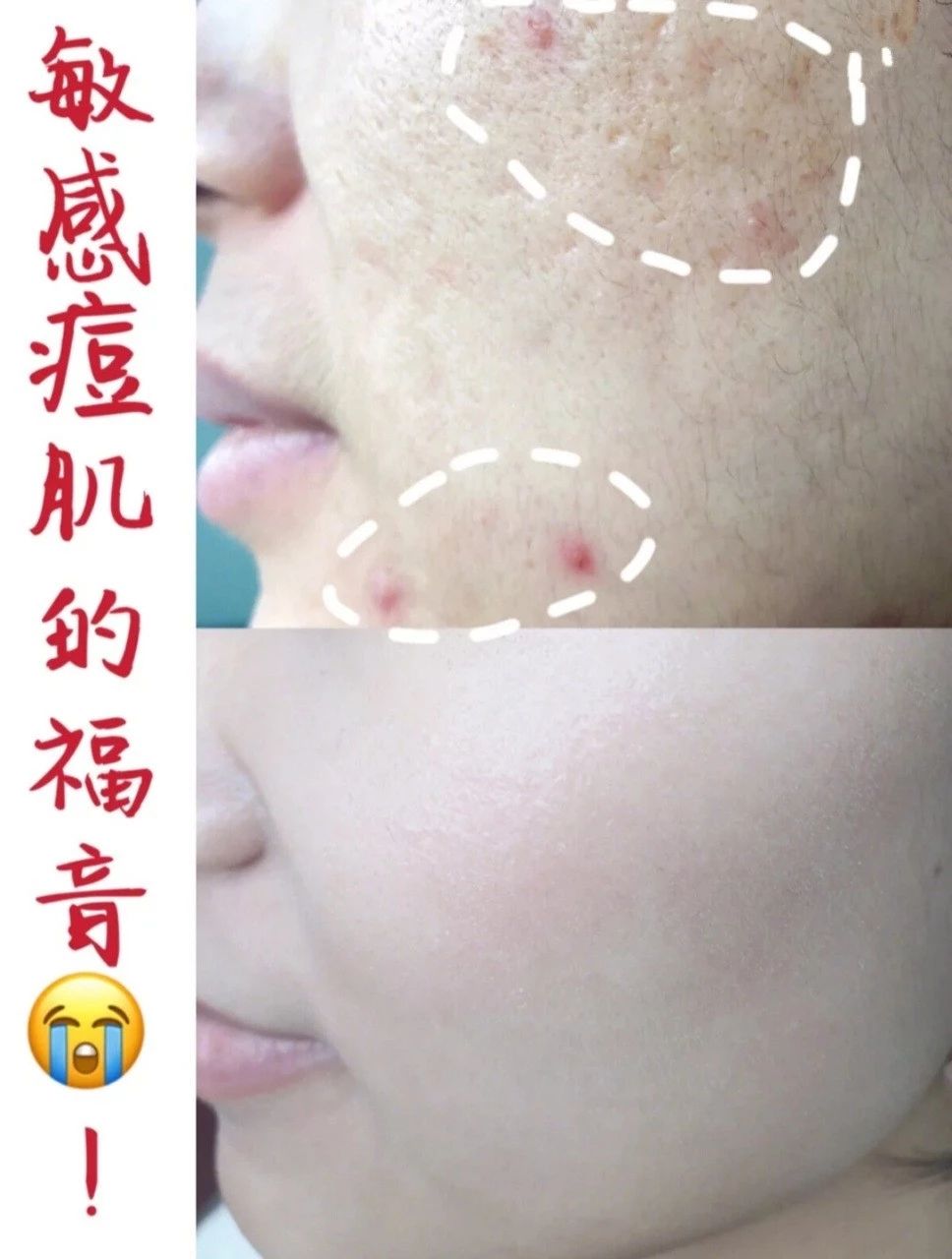 口罩大了戴口罩的小技巧,口罩继续戴防护不松懈