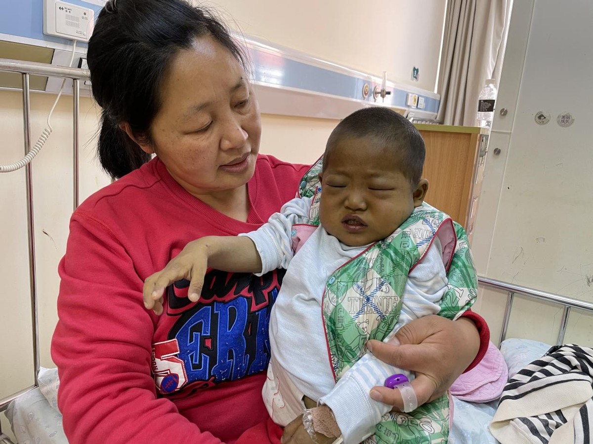 刚出生的小孩要换肝是什么病,小孩出生一星期眼睛黄