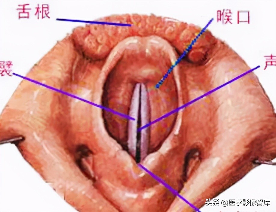 咽喉炎为什么要用治胃病的药