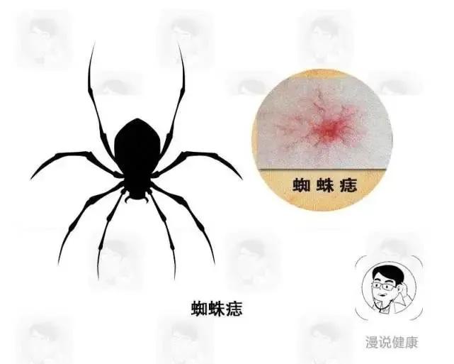 身上哪三处痒可能是癌症,身上起红疙瘩是癌症前期表现