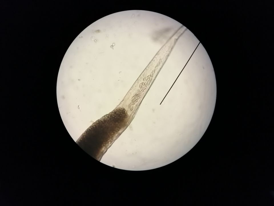 春季小心这些传染病,春季常见疾病预防及护理