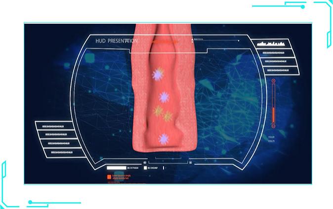 夫妻X生活不和谐暗藏的盆底肌松弛危机