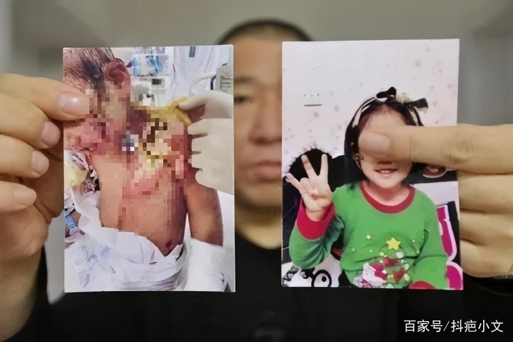 孩子不小心受伤了怎样问老师,孩子不小心摔伤怎么处理