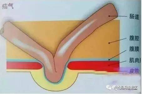大猪脐疝怎么解决,猪脐疝防治方法