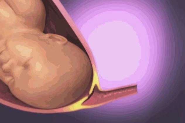 孕妇高清分娩全程图，从临产小征兆到正式胎儿娩出，早知道早准备