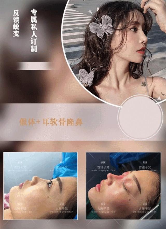 814元人气精华护理免费做！一次就焕颜新生！聚会女王就是你