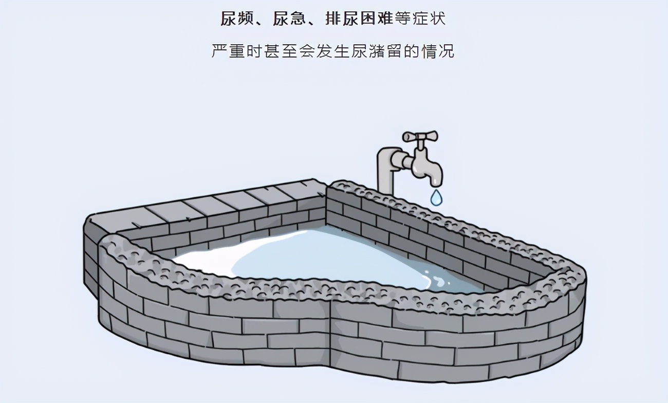 前列腺炎为什么久治不愈中医辨证,前列腺炎治不好病人自述