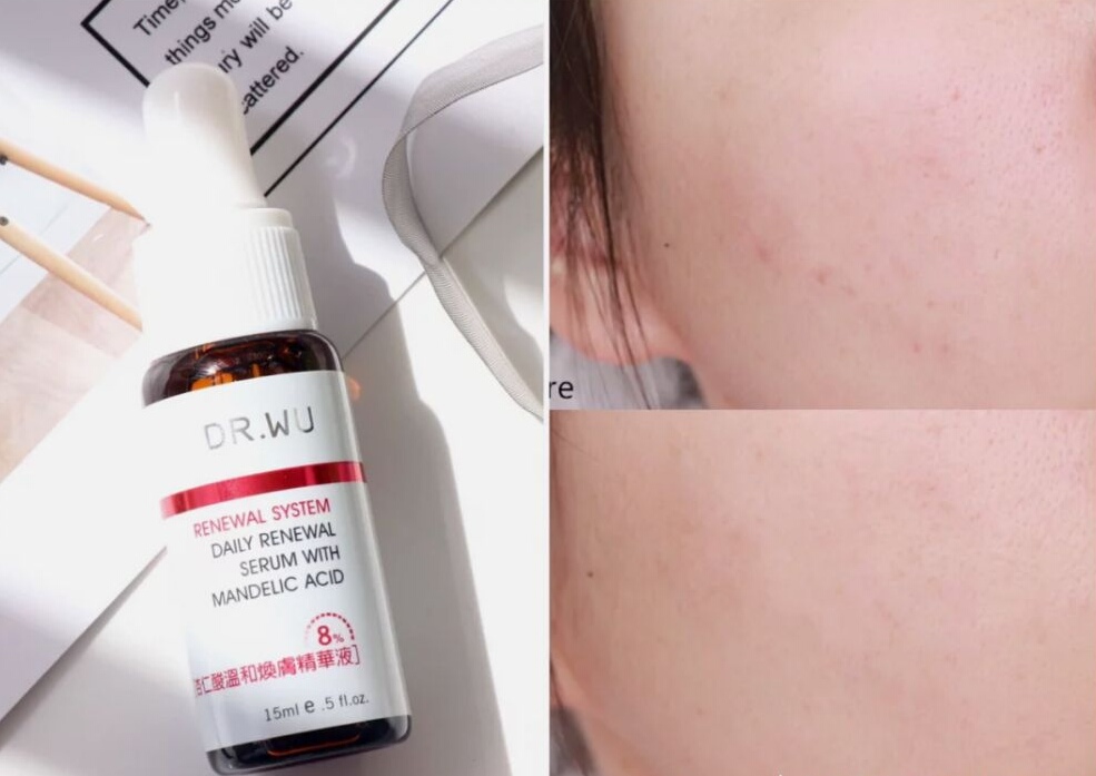 双十一避免剁手的法子,双十一剁手的看法