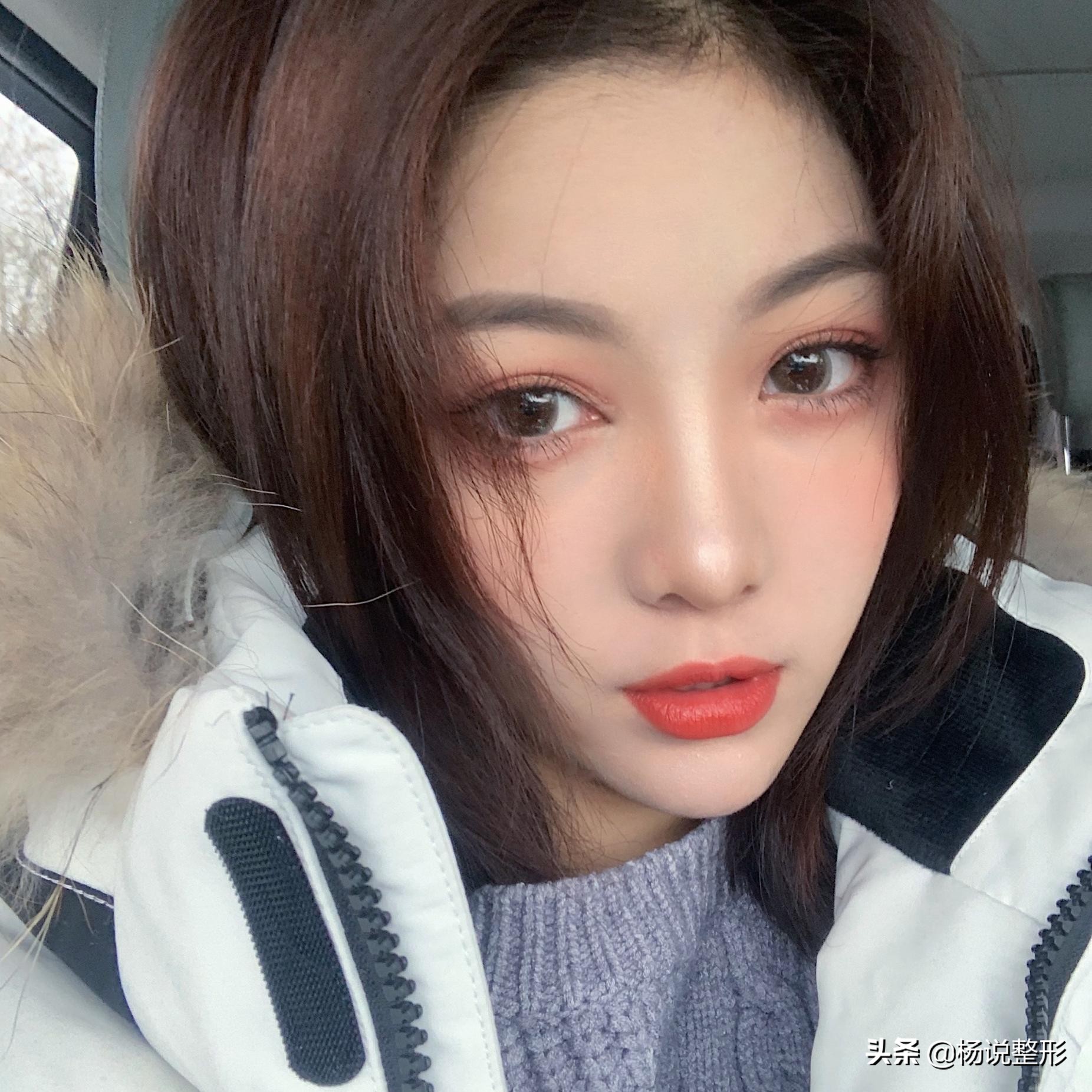 28岁做线雕提升脸部好不好,28岁女人做线雕现状