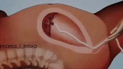 胎盘滞留子宫有什么后果,胎盘剥离不全为什么导致胎盘滞留