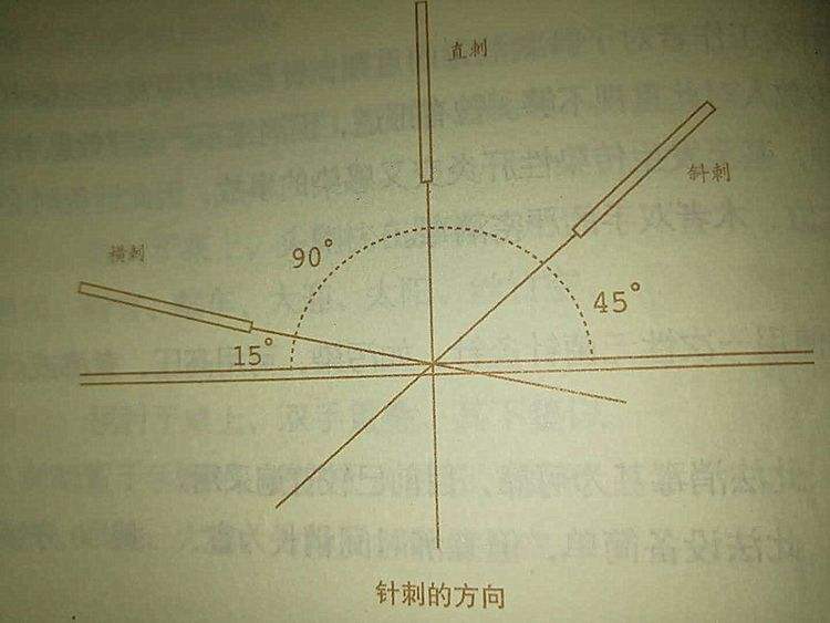 风池穴往上一掌是什么穴位,两风池穴中间是什么穴位
