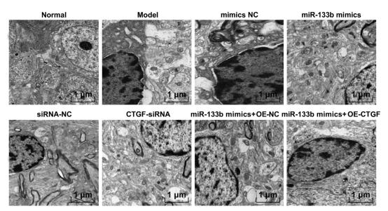双歧杆菌可以治疗抑郁焦虑吗,抑郁患者吃双歧杆菌有用吗