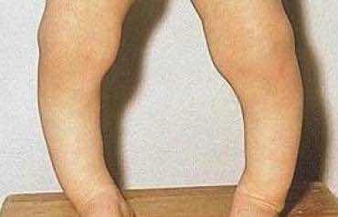 给宝宝买鱼肝油怎么选,宝宝吃进口鱼肝油好还是国产的好