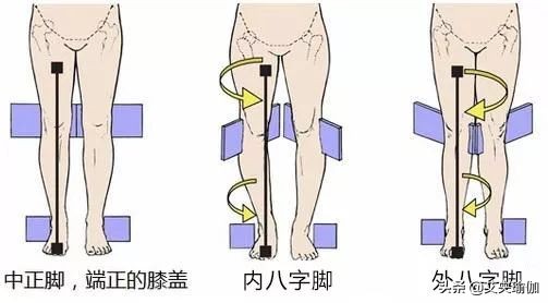 你的双腿之间有很大缝隙吗？你有假髋宽吗？假胯宽怎么避免和纠正