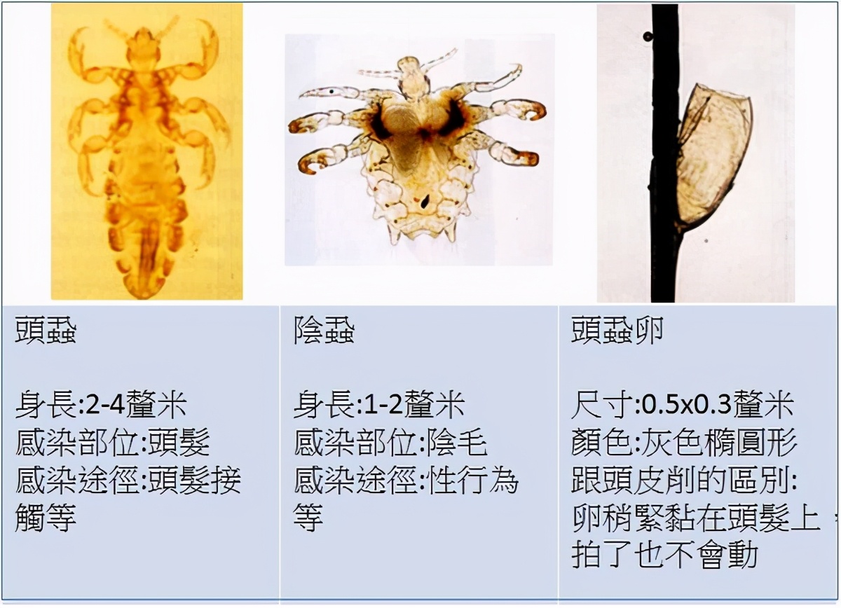 阴毛、腋毛和头发，人类在进化中为何保留了这几个部位的毛发？