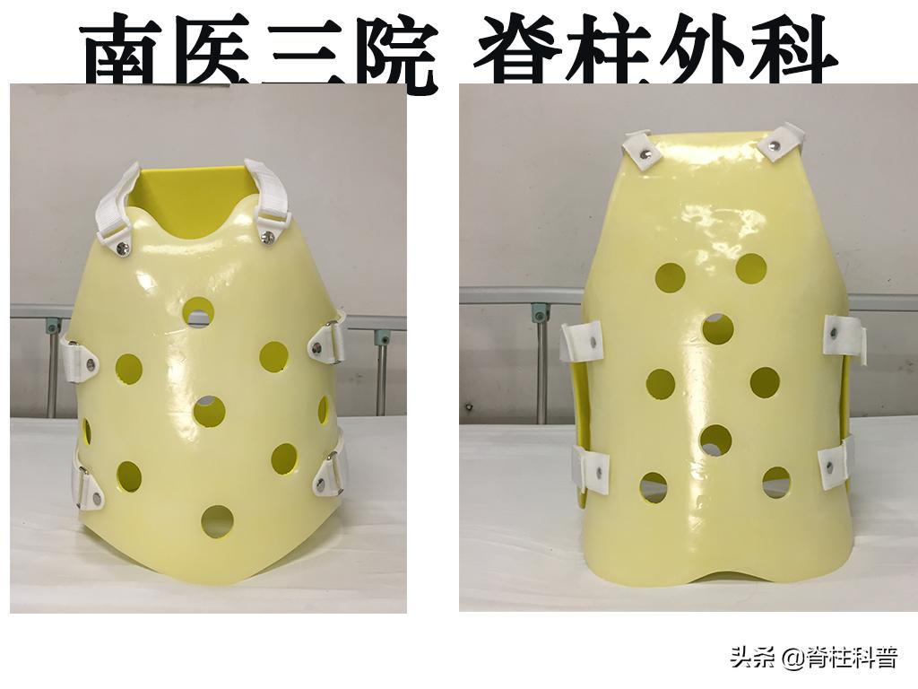 峡部裂导致滑脱有没有痊愈的可能,青少年峡部裂做哪种手术最好