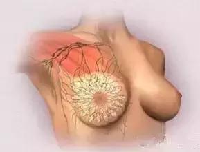 金牌月嫂催乳手法教程,奶结了硬块需要催乳师按摩几次