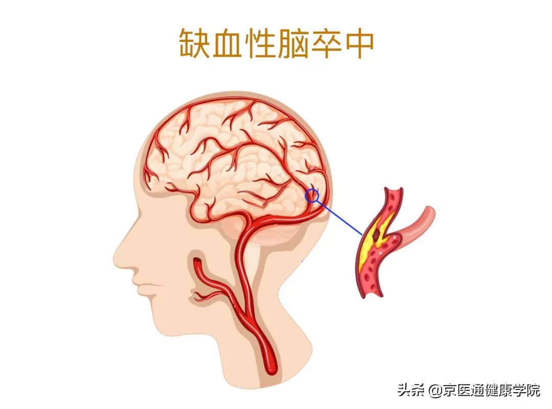 安宫牛黄丸神药吗,安宫牛黄丸是救命仙丹吗