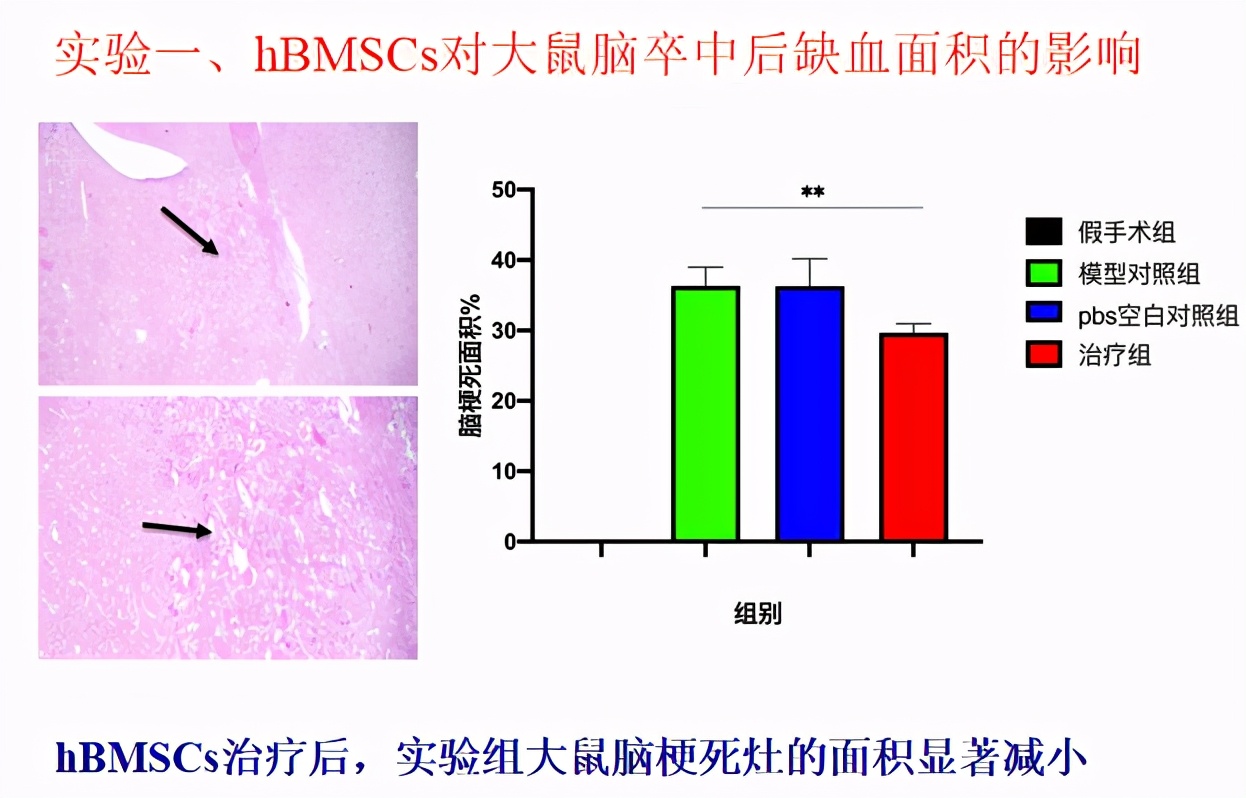自体造血干细胞能治疗什么病,干细胞治疗脑卒中医院