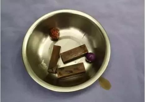 八岁女儿身体发出恶臭,女童身体发出阵阵臭味