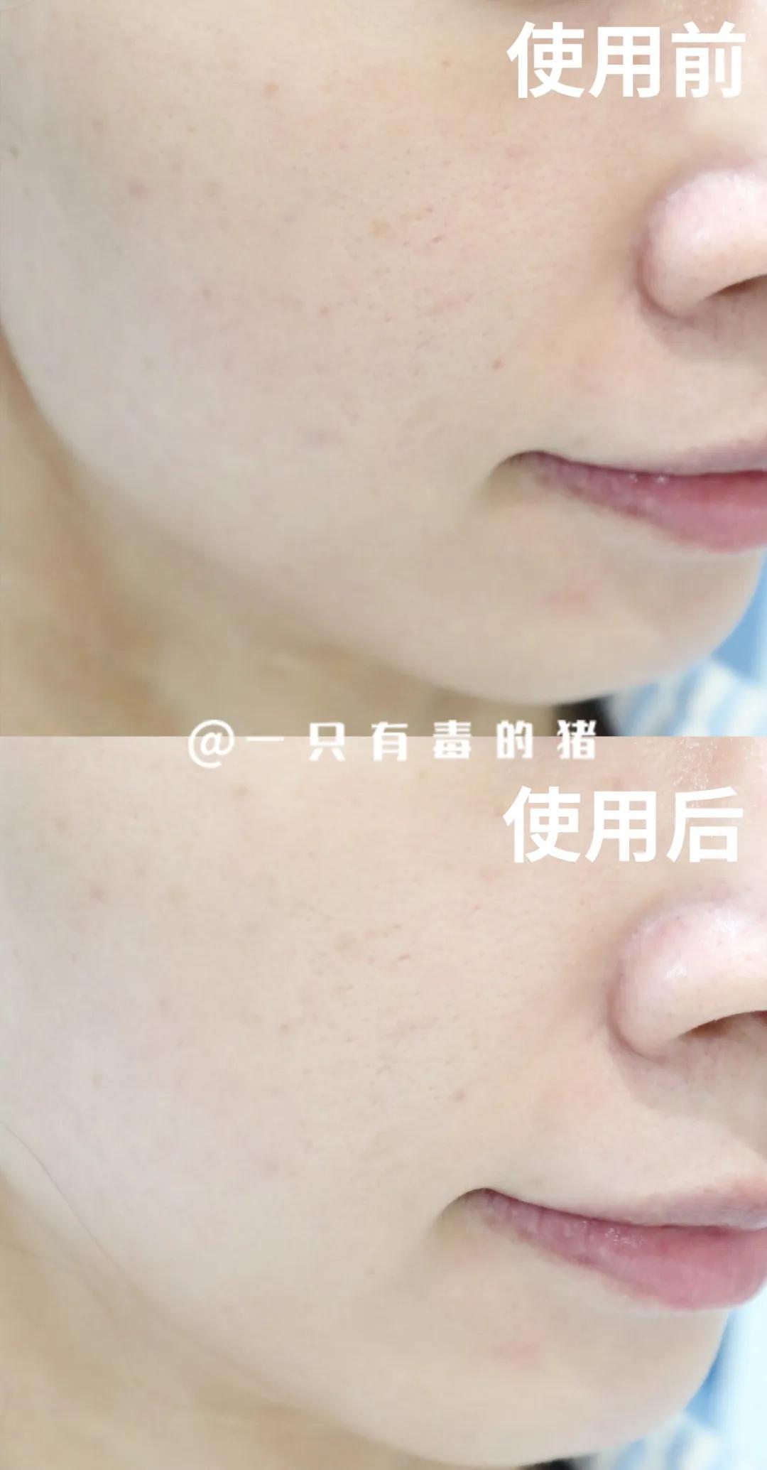 有哪些冷门好用的面膜,fresh和科颜氏白泥面膜哪个好用