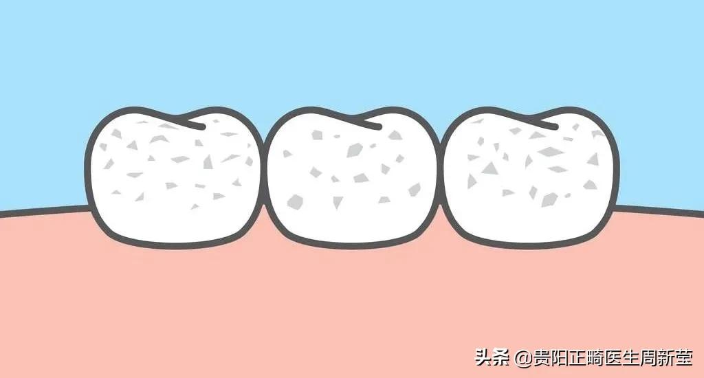 天天刷牙牙齿黑斑点,天天刷牙还是黄牙正确方法请收好